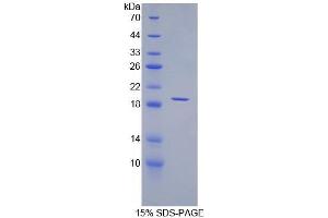 SDS-PAGE of Protein Standard from the Kit (Highly purified E. (Angiopoietin 1 Kit CLIA)