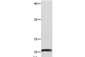 Western Blot analysis of Hela cell using NPY Polyclonal Antibody at dilution of 1:250 (NPY anticorps)