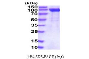 SDS-PAGE (SDS) image for Activated Leukocyte Cell Adhesion Molecule (ALCAM) (AA 28-527) protein (hIgG-His-tag) (ABIN6387963)