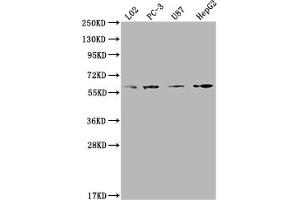 Western Blot Positive WB detected in: L02 whole cell lysate, PC-3 whole cell lysate, U87 whole cell lysate, HepG2 whole cell lysate All lanes: ICAM3 antibody at 1:2000 Secondary Goat polyclonal to rabbit IgG at 1/50000 dilution Predicted band size: 60 kDa Observed band size: 60 kDa (ICAM-3/CD50 anticorps  (AA 200-547))