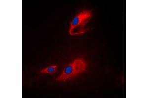 Immunofluorescent analysis of ACOT8 staining in Raji cells. (ACOT8 anticorps  (Center))