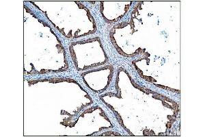 IHC analysis of AS160/TBC1D4 using anti-AS160/TBC1D4 antibody (ABIN7599745). (TBC1D4 anticorps  (AA 1118-1298))