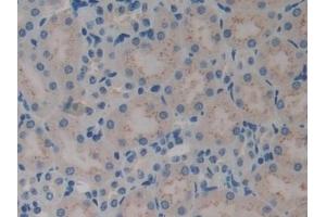 Detection of AIMP1 in Mouse Kidney Tissue using Polyclonal Antibody to Aminoacyl tRNA Synthetase Complex Interacting Multifunctional Protein 1 (AIMP1)