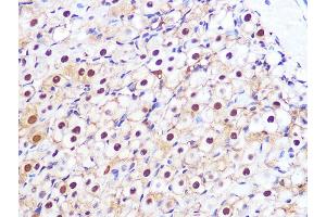 Immunohistochemistry of paraffin-embedded rat ovary using PSM Rabbit mAb (ABIN7269600) at dilution of 1:100 (40x lens). (PSMA3 anticorps)