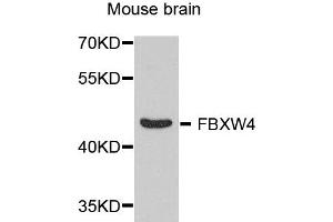Western blot analysis of extract of various cells, using FBXW4 antibody. (FBXW4 anticorps)