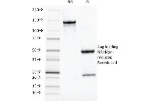 SDS-PAGE Analysis Purified TOX3 Mouse Monoclonal Antibody (TOX3/1124). (TOX3 anticorps  (AA 251-389))
