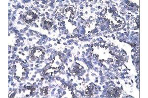 Image no. 1 for anti-Forkhead Box P1 (FOXP1) (AA 223-270) antibody (ABIN202867)