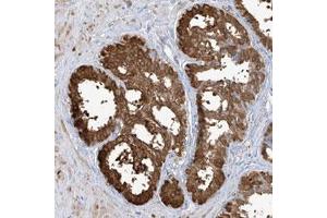 Immunohistochemical staining of human liver with TGM4 polyclonal antibody  shows strong cytoplasmic positivity in glandular cells.