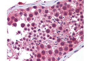 Immunohistochemistry (IHC) image for anti-Histone Deacetylase 6 (HDAC6) (N-Term) antibody (ABIN616900) (HDAC6 anticorps  (N-Term))