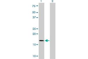 Western Blot analysis of TOMM22 expression in transfected 293T cell line by TOMM22 monoclonal antibody (M01), clone 4G4.
