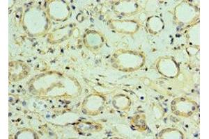 Immunohistochemistry of paraffin-embedded human kidney tissue using ABIN7175476 at dilution of 1:100 (VAMP3 anticorps  (AA 1-80))