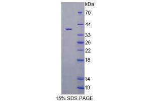SDS-PAGE analysis of Rat VNN1 Protein.