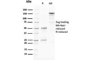 SDS-PAGE Analysis Purified PAPP-A Mouse Monoclonal Antibody (PAPPA/2716). (PAPPA anticorps  (AA 351-523))
