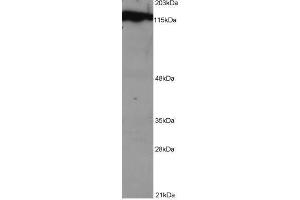 Image no. 1 for anti-Damage Specific DNA Binding Protein 1 (DDB1) (C-Term) antibody (ABIN374069) (DDB1 anticorps  (C-Term))
