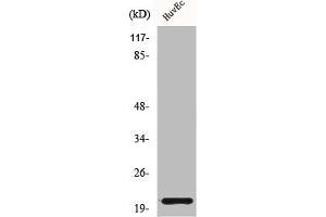 Western Blot analysis of HuvEc cells using Cardiotrophin-1 Polyclonal Antibody (Cardiotrophin 1 anticorps  (N-Term))