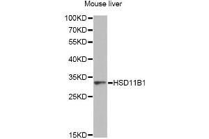 Western blot analysis of extracts of mouse liver, using HSD11B1 antibody. (HSD11B1 anticorps)