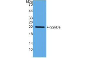 Figure. (IFNB1 anticorps  (AA 27-203))