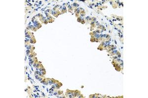 Immunohistochemistry of paraffin-embedded mouse lung using SERPINA3 antibody.