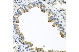 Immunohistochemistry of paraffin-embedded mouse lung using SERPINA3 antibody. (SERPINA3 anticorps  (AA 24-423))