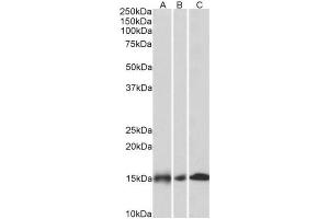 AP32031PU-N NDUFA7 Antibody staining of Human (A), Mouse (B) and Rat (C) Heart lysates (35µg protein in RIPA buffer) at 0. (NDUFA7 anticorps  (Internal Region))