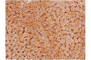 ABIN6267578 at 1/200 staining Mouse liver tissue sections by IHC-P.
