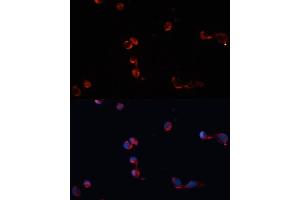 Immunofluorescence analysis of HeLa cells using Catalasealase antibody (ABIN6133450, ABIN6137987, ABIN6137989 and ABIN6215464) at dilution of 1:100. (Catalase anticorps  (AA 1-225))