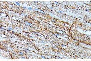 Immunohistochemistry of paraffin-embedded Rat heart using SLC14A1 Polyclonal Antibody at dilution of 1:100 (40x lens). (SLC14A1 anticorps)