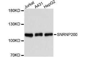 Western blot analysis of extracts of various cell lines, using SNRNP200 antibody (ABIN1877090) at 1:3000 dilution.