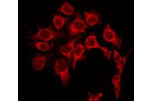 ABIN6268996 staining Hela by IF/ICC. (PRKACA anticorps  (Internal Region))