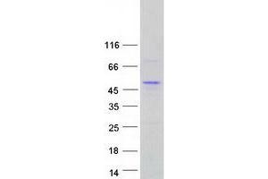 Validation with Western Blot