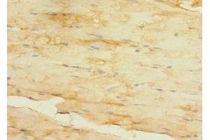 Immunohistochemistry of paraffin-embedded human skeletal muscle tissue using ABIN7176531 at dilution of 1:100