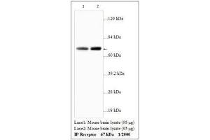 Image no. 1 for anti-Prostacyclin Receptor (PTGIR) antibody (ABIN791360) (Prostacyclin Receptor anticorps)