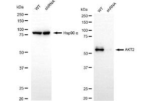 Western blotting analysis using AKT2 antibody (ABIN7800788).