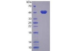 SDS-PAGE analysis of Human CAMK1 Protein. (CAMK1 Protéine)