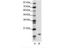 Image no. 1 for anti-TATA-Binding Protein-Associated Phosphoprotein (DR1) (N-Term) antibody (ABIN202041) (DR1 anticorps  (N-Term))