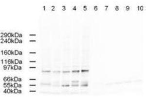 Western blot using  Affinity Purified anti-AP2A antibody shows detection of a band just below 100 kDa correspond-ing to Human AP2A1 in a various preparations. (alpha Adaptin anticorps  (AA 3-14))