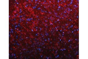 IF analysis of RIMBP2 using anti-RIMBP2 antibody (ABIN7601441). (RIMBP2 anticorps  (AA 351-1049))