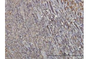 Image no. 1 for anti-RAB6A, Member RAS Oncogene Family (RAB6A) (AA 109-208) antibody (ABIN598568) (RAB6A anticorps  (AA 109-208))