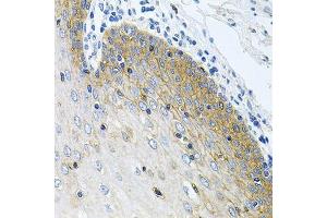 Immunohistochemistry of paraffin-embedded human esophagus using GNE antibody.