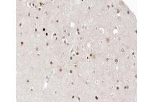 ABIN6266561 at 1/100 staining human brain tissue sections by IHC-P. (HDAC9 anticorps  (C-Term))