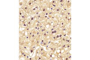 (ABIN6242522 and ABIN6577190) staining PGK1 in human liver tissue sections by Immunohistochemistry (IHC-P - paraformaldehyde-fixed, paraffin-embedded sections).