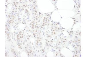 Immunohistochemistry (IHC) image for anti-TAR DNA Binding Protein (TARDBP) (AA 250-300) antibody (ABIN7454906)