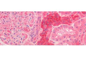 Detection of CALB in Human Kidney Tissue using Polyclonal Antibody to Calbindin (CALB)