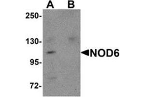 Western blot analysis of NOD6 in EL4 cell lysate with NOD6 antibody at 1 μg/ml in the (A) absence and (B) presence of blocking peptide. (NLRP9 anticorps  (N-Term))
