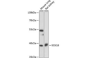 Western blot analysis of extracts of various cell lines, using SOX18 antibody (ABIN7270572) at 1:1000 dilution.