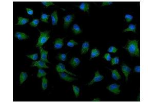 IF analysis of ATG9A using anti-ATG9A antibody (ABIN7599557). (ATG9A anticorps  (AA 1-812))