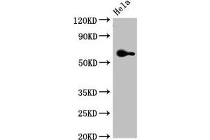 Western Blot Positive WB detected in: Hela whole cell lysate All lanes: FZD4 antibody at 3. (FZD4 anticorps  (AA 37-222))