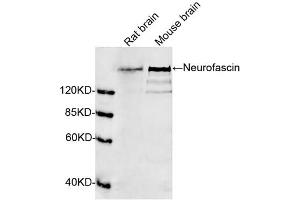 Western blot analysis of tissue lysates using 1 µg/mL Rabbit Anti-Neurofascin Polyclonal Antibody (ABIN398840) The signal was developed with IRDyeTM 800 Conjugated Goat Anti-Rabbit IgG. (NFASC anticorps  (N-Term))