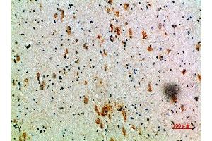 Immunohistochemical analysis of paraffin-embedded human-brain, antibody was diluted at 1:200