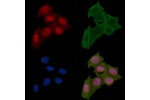 ABIN6257009 and ABIN6274409 staining Hela cells(24h of starvation treatment) by IF/ICC. (MOB1A anticorps  (N-Term))